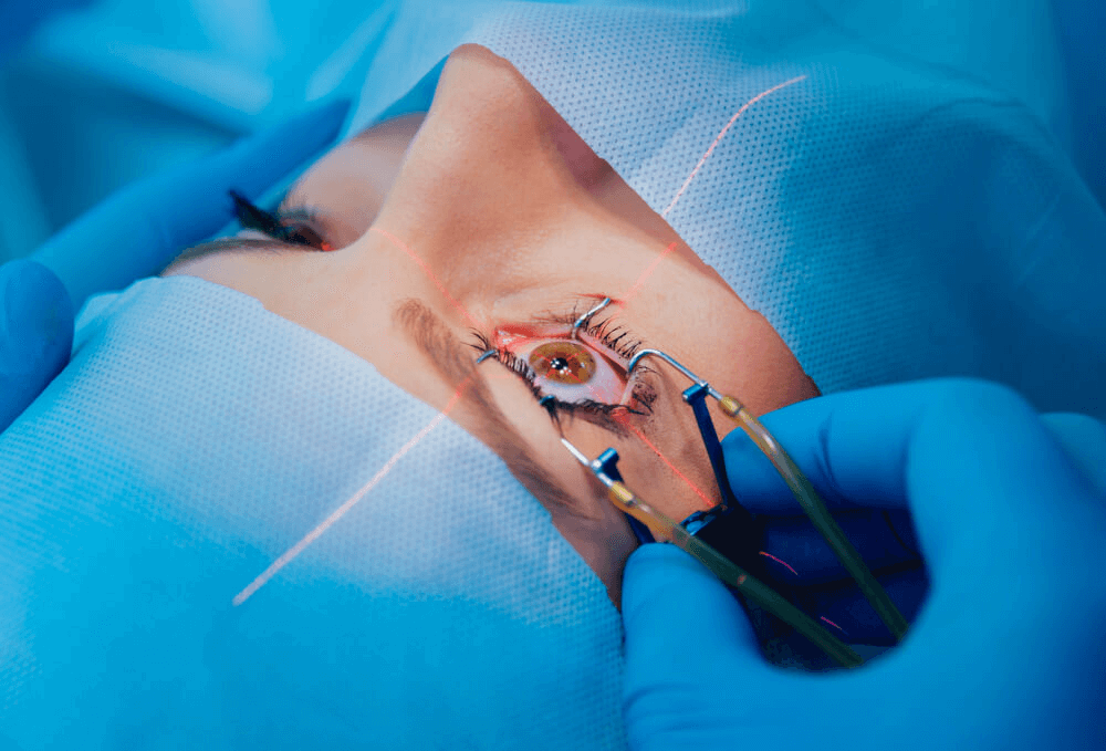 From Cloudy to Crystal-Clear: See the World Brightly After Cataract Surgery